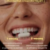Инозитол мио 1500 мг для похудения 120 капсул 7 Инозитол мио 1500 мг для похудения 120 капсул — фото 7